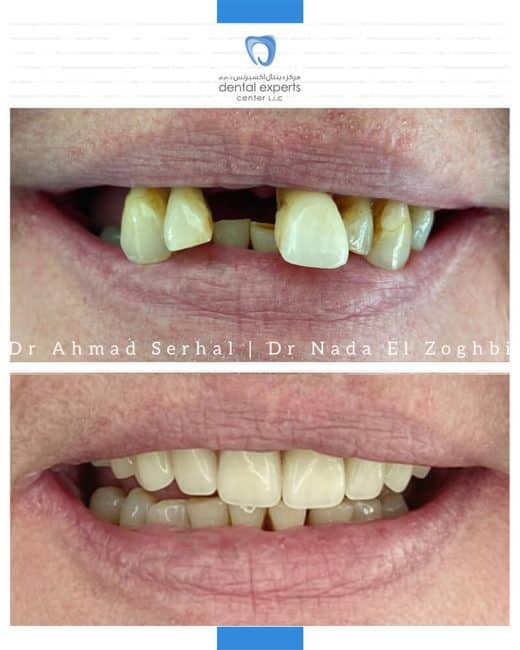 Before and after dental case — Case 3