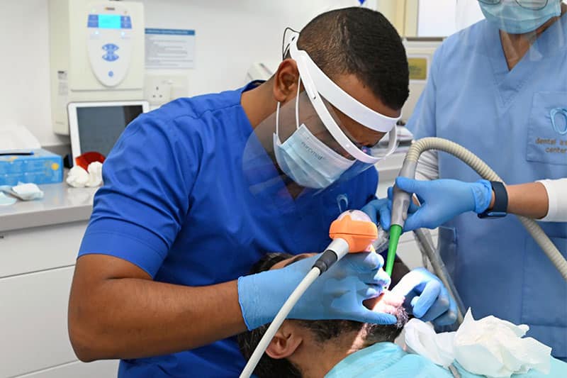Composite Fillings