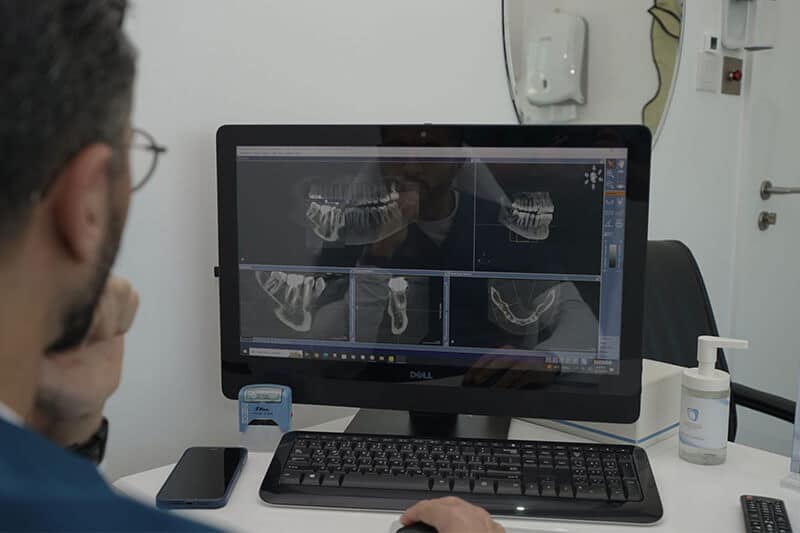 Dental Emergencies